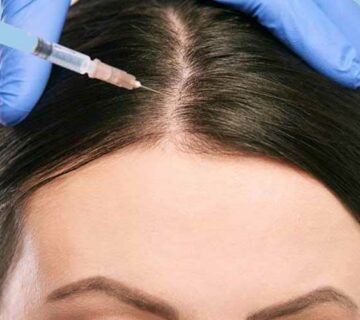 مزوتراپی مو برای درمان ریزش مو و رشد مجدد مو
