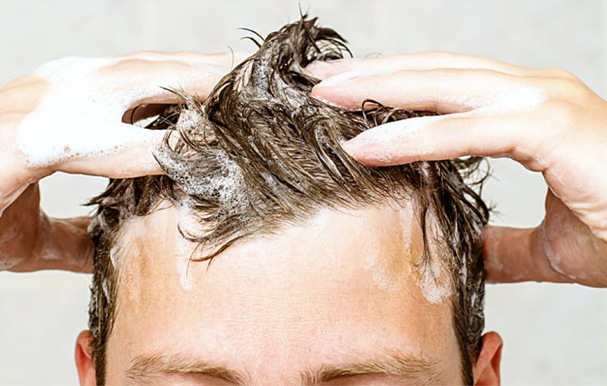 شستن سر بعد از کاشت مو
