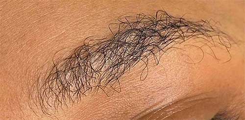 نتیجه کاشت ابروی نامناسب با موهای بسیار فر