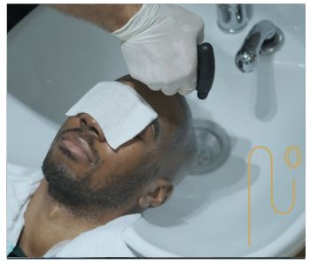 Treatment-of-scabs-and-wounds-after-hair-transplantation درمان دلمه و زخم بعد از کاشت مو