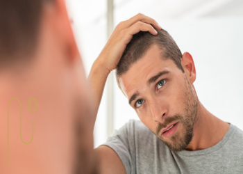 Genetic-problems-and-their-role-in-hair-loss مشکلات ژنتیکی و نقش آنها در ریزش مو