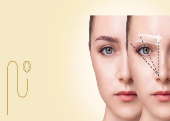 مراحل کاشت ابرو به روش FUE