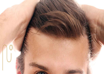 Hair-transplant-in-summer-and-winter کاشت مو در تابستان و زمستان