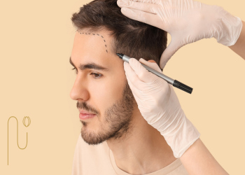 Hair-transplantation-in-the-fall کاشت مو در پاییز