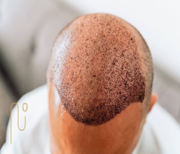 فواید مصرف سیر بر سرعت بهبودی بعد از کاشت