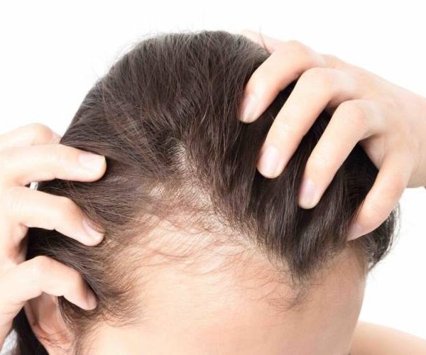 دست زدن به موهای کاشته شده